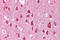 Solute Carrier Family 18 Member A1 antibody, 25-274, ProSci, Immunohistochemistry frozen image 