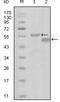 EPH Receptor A6 antibody, MA5-15468, Invitrogen Antibodies, Western Blot image 