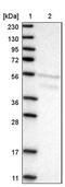 AE Binding Protein 2 antibody, PA5-54584, Invitrogen Antibodies, Western Blot image 