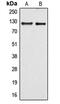 Rho Guanine Nucleotide Exchange Factor 1 antibody, GTX55910, GeneTex, Western Blot image 