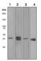 Alcohol Dehydrogenase 1A (Class I), Alpha Polypeptide antibody, ab108203, Abcam, Western Blot image 