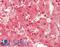 RAB7A antibody, LS-B14857, Lifespan Biosciences, Immunohistochemistry paraffin image 