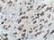 Beta-Secretase 1 antibody, 12807-1-AP, Proteintech Group, Immunohistochemistry paraffin image 