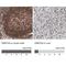 DNA Methyltransferase 3 Alpha antibody, NBP1-85961, Novus Biologicals, Immunohistochemistry paraffin image 