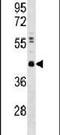 Chromobox 8 antibody, PA5-12202, Invitrogen Antibodies, Western Blot image 