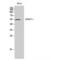 Cholinergic Receptor Nicotinic Beta 1 Subunit antibody, LS-C381870, Lifespan Biosciences, Western Blot image 