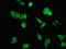Acyl-CoA Synthetase Long Chain Family Member 1 antibody, LS-C670610, Lifespan Biosciences, Immunofluorescence image 