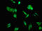 Acsl2 antibody, LS-C670610, Lifespan Biosciences, Immunofluorescence image 