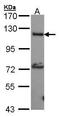 Adenylate Cyclase 2 antibody, GTX101360, GeneTex, Western Blot image 
