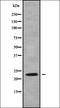 RAB13, Member RAS Oncogene Family antibody, orb338609, Biorbyt, Western Blot image 