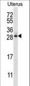 ADP Ribosylation Factor Like GTPase 8A antibody, LS-C156497, Lifespan Biosciences, Western Blot image 