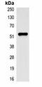 Methyltransferase Like 7B antibody, orb75092, Biorbyt, Immunoprecipitation image 