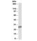 Troponin I3, Cardiac Type antibody, R34692-100UG, NSJ Bioreagents, Western Blot image 