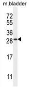 TIFA Inhibitor antibody, AP54250PU-N, Origene, Western Blot image 