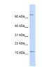 Nuclear Receptor 2C2 Associated Protein antibody, NBP1-56746, Novus Biologicals, Western Blot image 