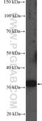 Metabolism Of Cobalamin Associated C antibody, 21462-1-AP, Proteintech Group, Western Blot image 