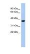 Phospholipid Phosphatase 6 antibody, NBP1-60021, Novus Biologicals, Western Blot image 