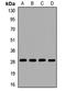 Mitochondrial Ribosomal Protein S18B antibody, LS-C668735, Lifespan Biosciences, Western Blot image 