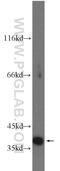 Cyclin Dependent Kinase 6 antibody, 19117-1-AP, Proteintech Group, Western Blot image 