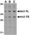 MCL1 Apoptosis Regulator, BCL2 Family Member antibody, TA306209, Origene, Western Blot image 