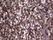 Thyroglobulin antibody, LS-C339080, Lifespan Biosciences, Immunohistochemistry paraffin image 