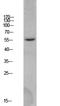 Beta-Secretase 1 antibody, STJ99605, St John