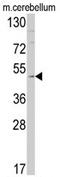 ET-BR antibody, AP17303PU-N, Origene, Western Blot image 