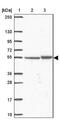 Transmembrane Protein 246 antibody, NBP2-33702, Novus Biologicals, Western Blot image 