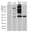 Homer Scaffold Protein 1 antibody, LS-C796074, Lifespan Biosciences, Western Blot image 