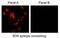 Carbonic Anhydrase 9 antibody, NB100-417B, Novus Biologicals, Immunocytochemistry image 