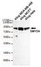 SET And MYND Domain Containing 4 antibody, GTX49257, GeneTex, Western Blot image 