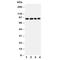Interleukin 4 Receptor antibody, R30699, NSJ Bioreagents, Western Blot image 