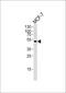 Suppressor Of Cytokine Signaling 4 antibody, PA5-35075, Invitrogen Antibodies, Western Blot image 