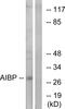 NAD(P)HX Epimerase antibody, GTX87985, GeneTex, Western Blot image 