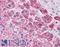 Platelet Derived Growth Factor Receptor Alpha antibody, LS-B4840, Lifespan Biosciences, Immunohistochemistry paraffin image 