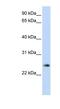 Thymocyte Nuclear Protein 1 antibody, NBP1-55405, Novus Biologicals, Western Blot image 