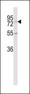 Carboxypeptidase Z antibody, GTX81852, GeneTex, Western Blot image 