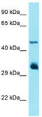 Interferon Induced Protein With Tetratricopeptide Repeats 1 antibody, TA337349, Origene, Western Blot image 