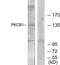 Zinc Finger MYND-Type Containing 8 antibody, LS-B9151, Lifespan Biosciences, Western Blot image 