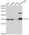 Voltage Dependent Anion Channel 1 antibody, A13638, ABclonal Technology, Western Blot image 