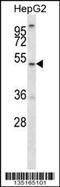 ALG11 Alpha-1,2-Mannosyltransferase antibody, 58-064, ProSci, Western Blot image 