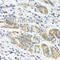Interleukin-11 antibody, A1902, ABclonal Technology, Immunohistochemistry paraffin image 