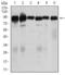 Transforming Growth Factor Beta Receptor 3 antibody, GTX60678, GeneTex, Western Blot image 