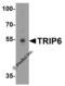 Thyroid Hormone Receptor Interactor 6 antibody, 6001, ProSci, Western Blot image 