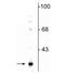 Glutathione S-Transferase Kappa 1 antibody, NBP2-60791, Novus Biologicals, Western Blot image 