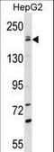 Patatin Like Phospholipase Domain Containing 6 antibody, LS-C163827, Lifespan Biosciences, Western Blot image 