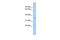 C-Type Lectin Domain Family 4 Member G antibody, GTX45168, GeneTex, Western Blot image 