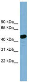 LanC Like 2 antibody, TA344842, Origene, Western Blot image 