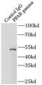 Peroxisome Proliferator Activated Receptor Gamma antibody, FNab06660, FineTest, Immunoprecipitation image 