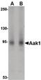 AP2 Associated Kinase 1 antibody, PA5-20616, Invitrogen Antibodies, Western Blot image 